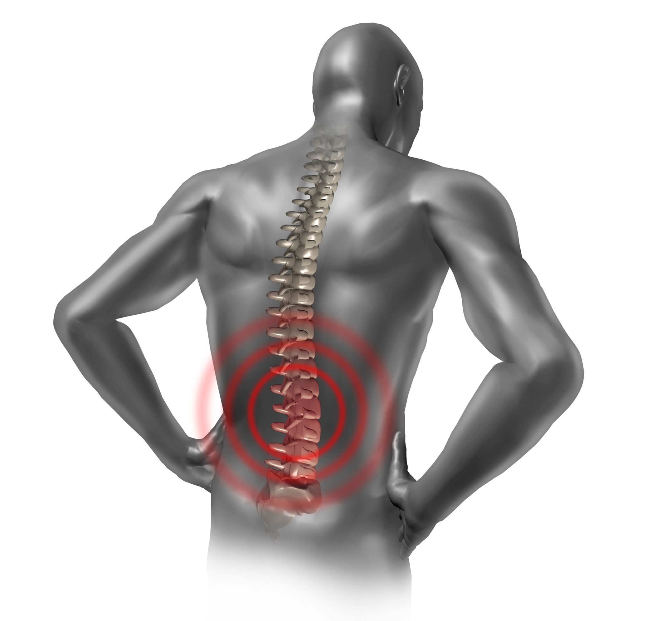 Epidural Steroid Injections in Moore for Effective Relief of Back Pain