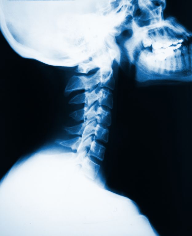 Tips for Choosing the Best Chiropractors in Corinth, MS