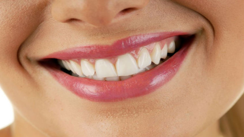 Everything you want to know about dental implants