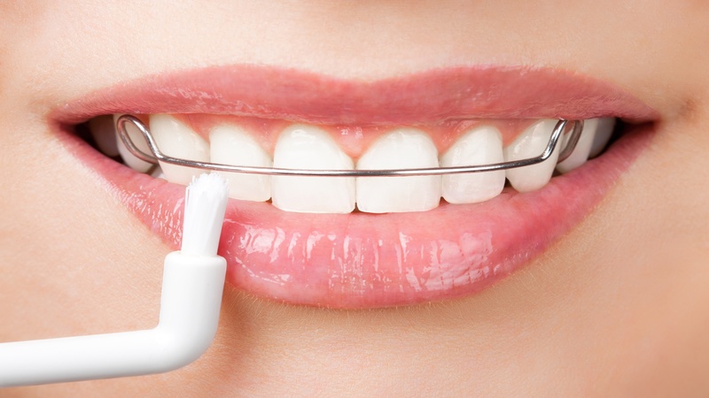 The Virtues of Getting Orthodontic Treatment in Vancouver, WA