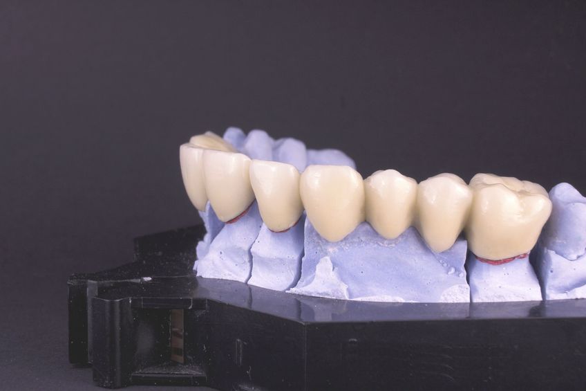 Restore Your Smile with a Tooth Crown in Philadelphia, PA