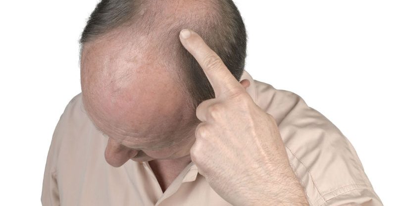 The Path to Fuller Hair: Unveiling Fue Hair Transplant in Washington DC
