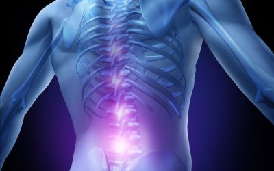 Does Spinal Decompression Therapy Improve Spine Alignment?