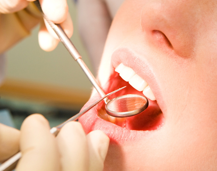 Restore Confidence in Eating and Speaking with Implant Retained Dentures, Richland, WA