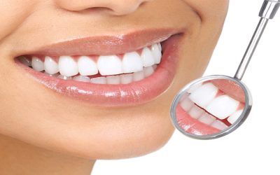 Reclaim your smile’s sparkle with teeth whitening in Kelowna