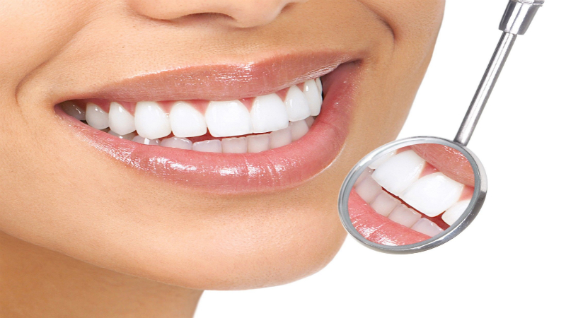 Reclaim your smile’s sparkle with teeth whitening in Kelowna