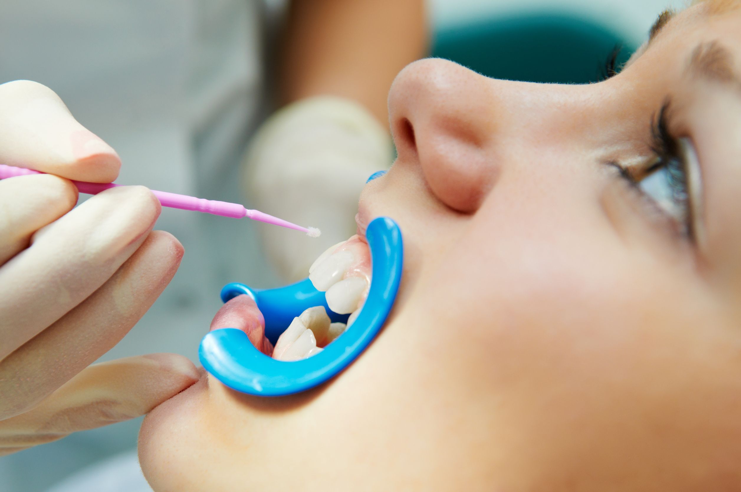 Are Dental Implants Coral Springs FL the Right Choice for You? Learn More Here