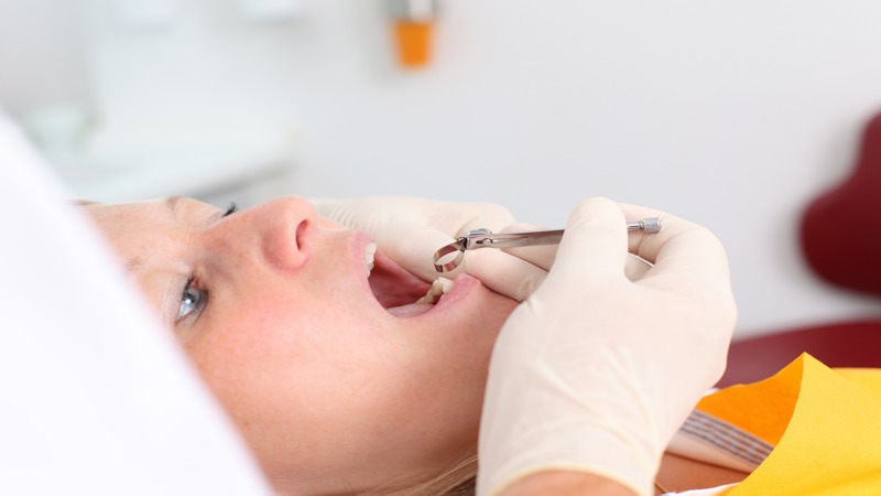 Why Choose a Dentist in Wilton Manors FL for Your Oral Health?