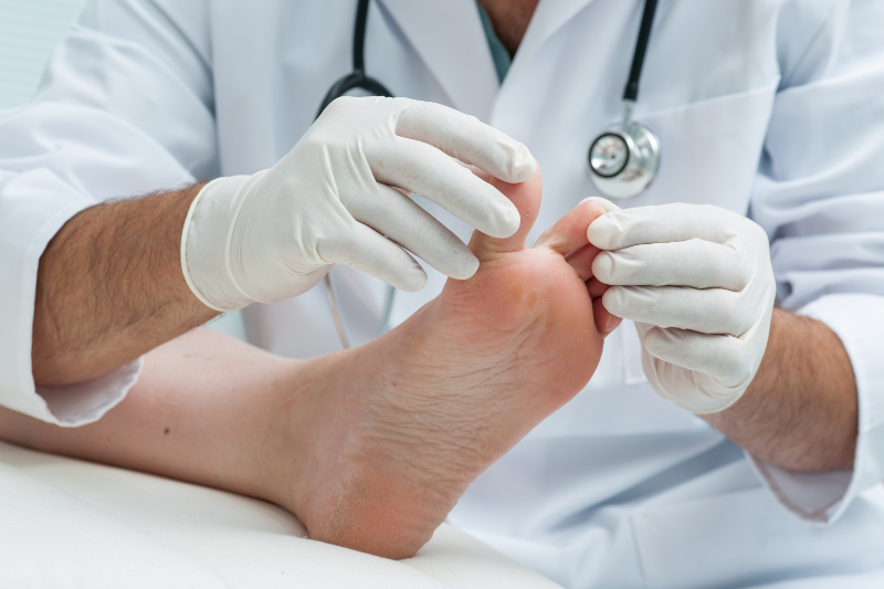 When Is It Time to See a Bunion Doctor? 5 Warning Signs You Shouldn’t Ignore