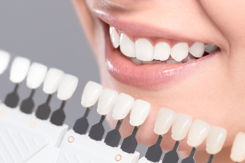 Achieve a Brighter Smile with a Cosmetic Dentist Troy MI for Lasting Confidence