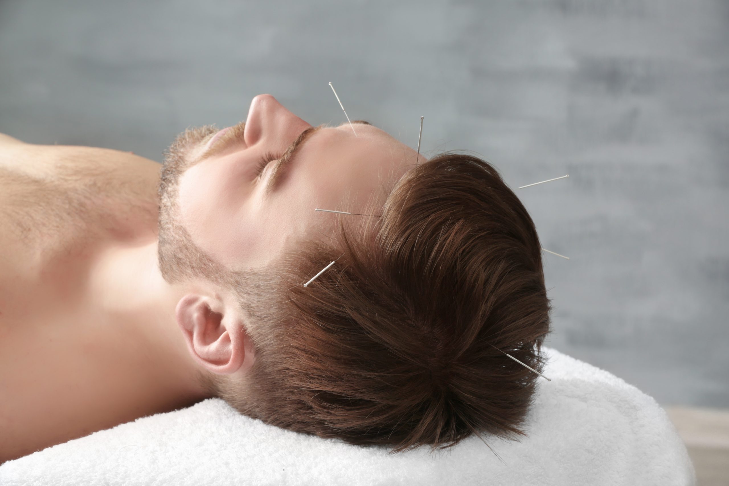 Experience Transformative Skin Renewal With Microneedling Burr Ridge Solutions