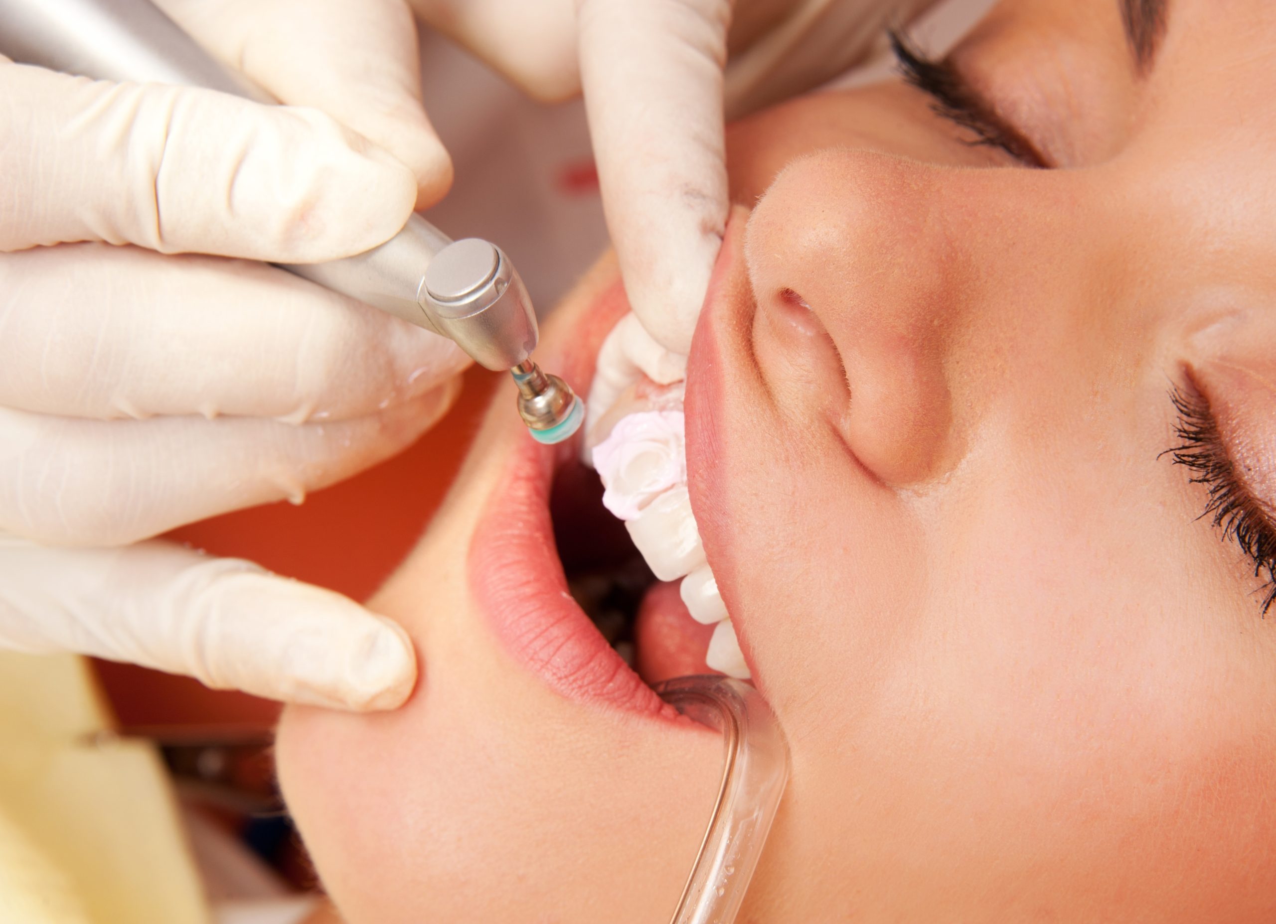 Find Trusted Family Solutions with Dental Care in Coral Springs, FL for Healthy Smiles