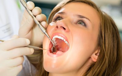 Reasons Dental Implants Middleton WI Offer LongLasting Tooth Replacement Solutions