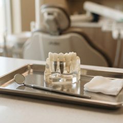 Everything You Should Know Before Getting a Dental Implant